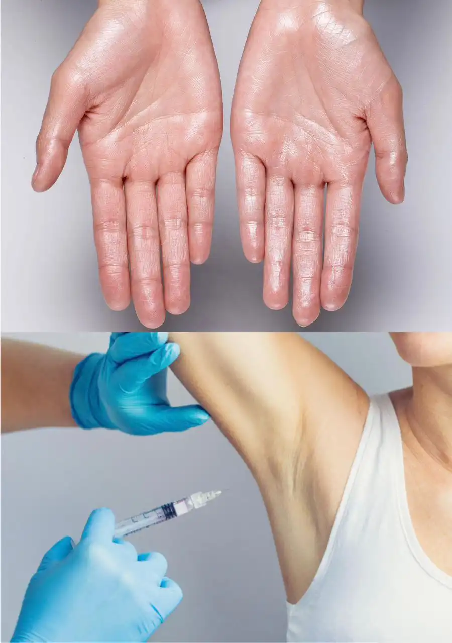 Top half of photo shows sweaty palms, bottom half of photo showing an injection into the armpit.