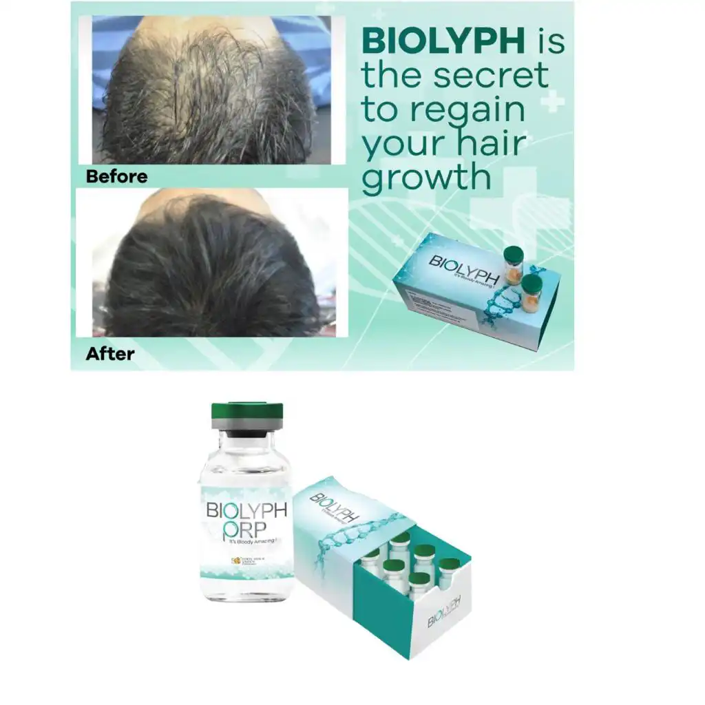 Before and after image of a person's thin hair becoming a head full of hair after using Biolyph.