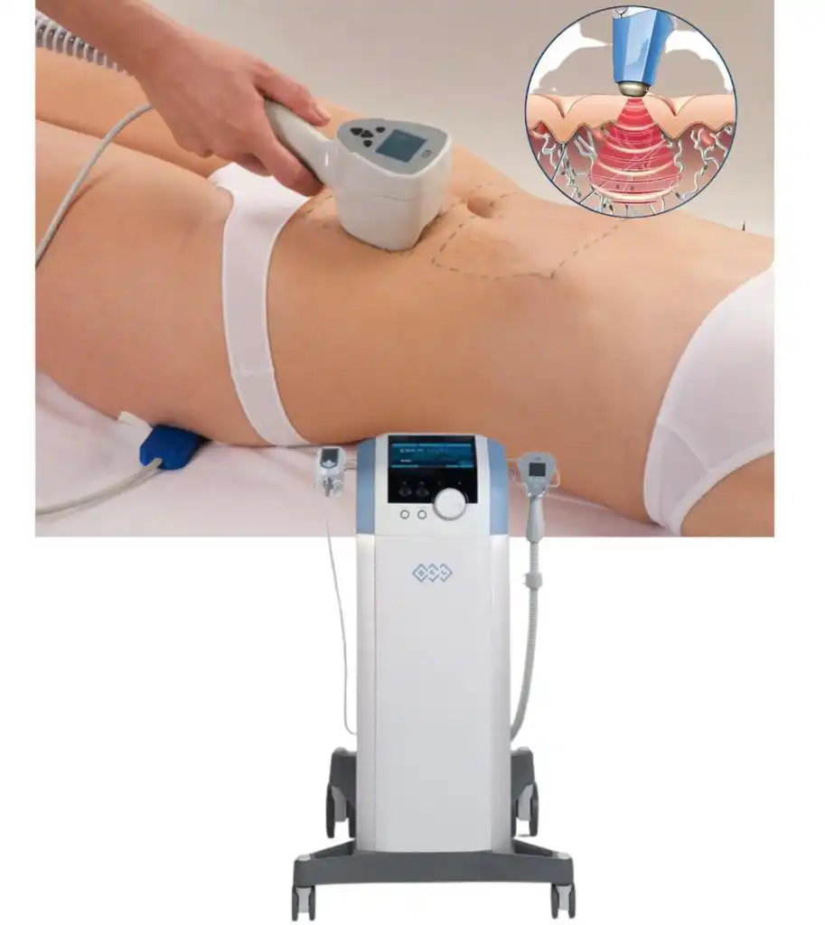 A woman undergoing Exilis body treatment