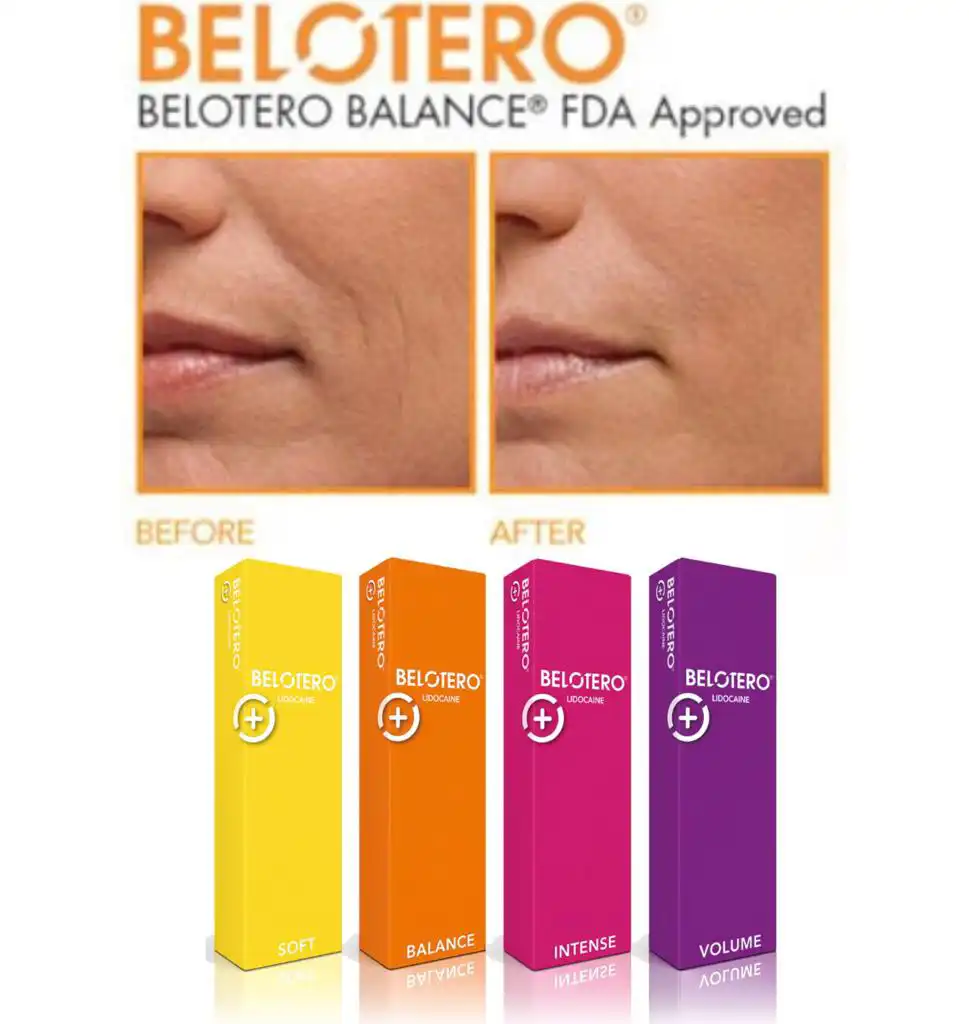 Before and after comparison images of someone's wrinkles fading after using dermal fillers