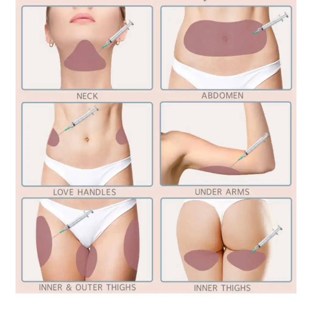A series of images showing where mesolipolysis treatment is applied, namely the neck, abdomen, love handles, under arms, and finally the inner and outer thighs.