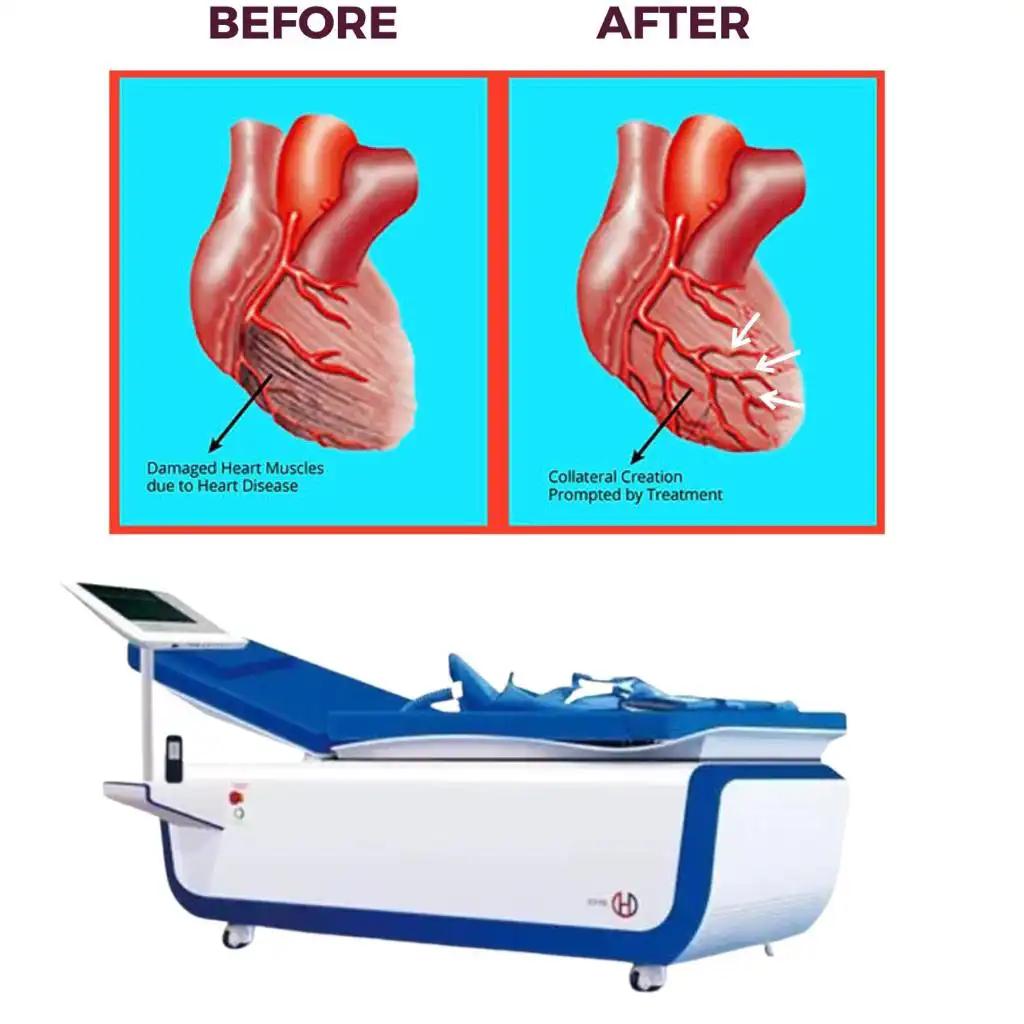 Before and after images showing a heart with damaged heart muscles due to heart disease being fixed by treatment