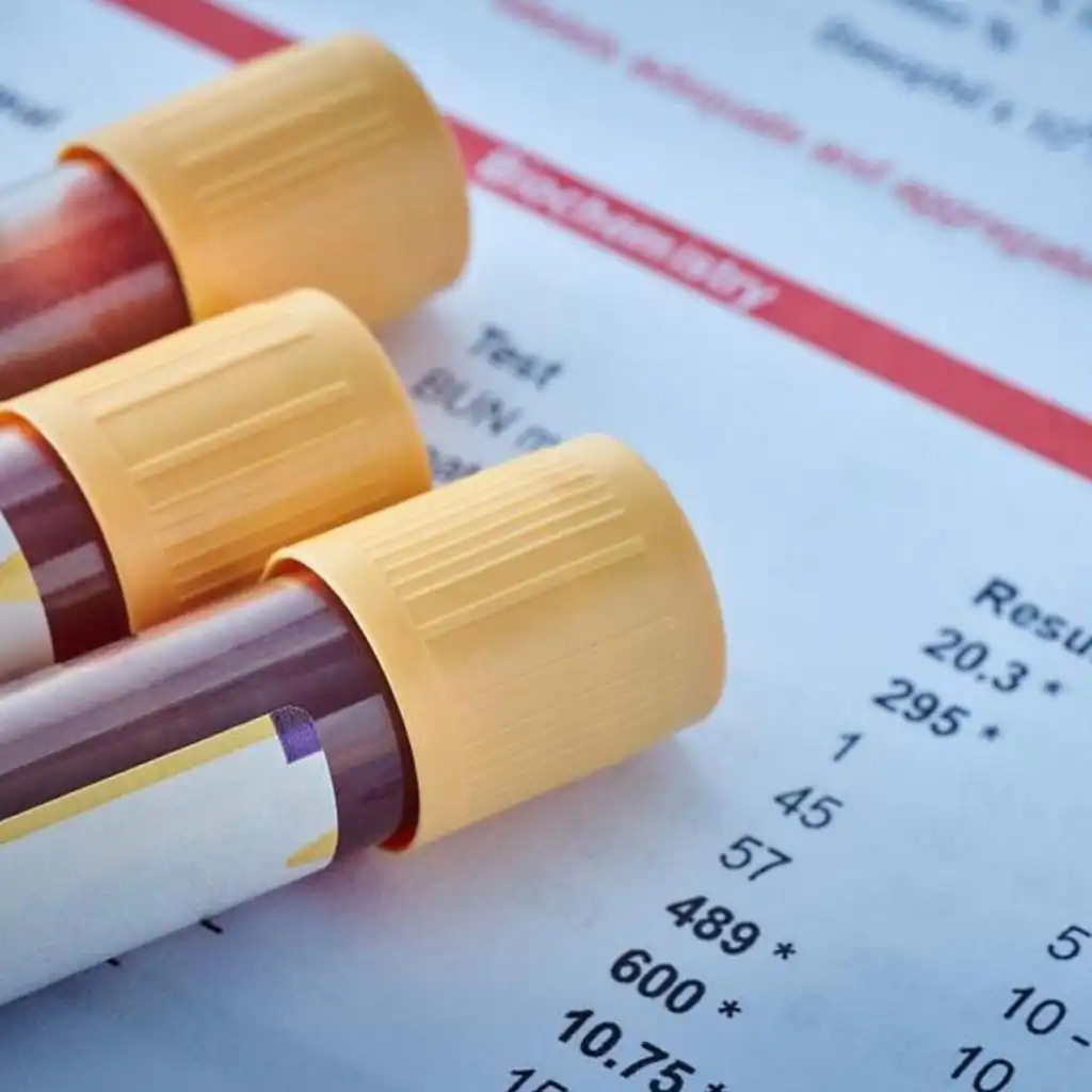 Image of the results of a blood test